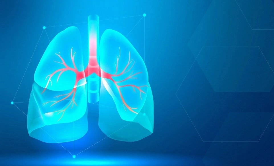 Asthma